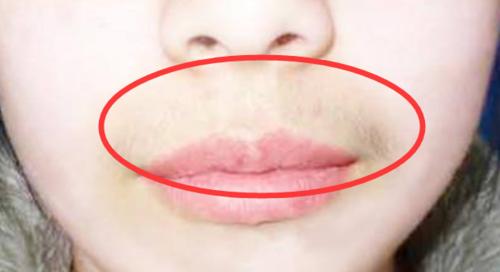 女生有胡子怎么处理？（正确处理女生面部胡子的方法和技巧）
