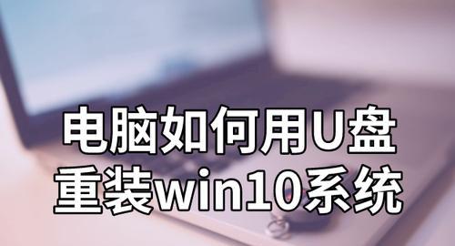 一键装机win10系统的便捷操作（让你轻松完成系统安装的利器）