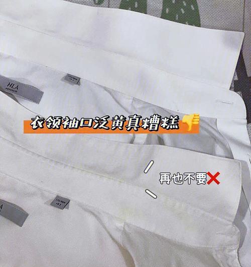 领子发黄怎么办（15个实用的方法帮你轻松解决领子发黄难题）