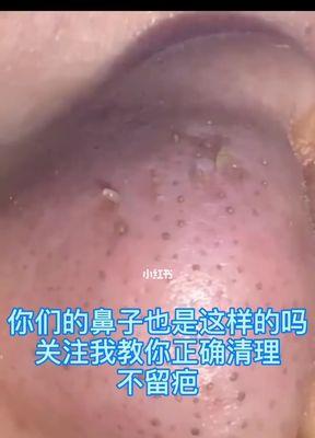 毛孔粗大（美肌秘籍揭秘）