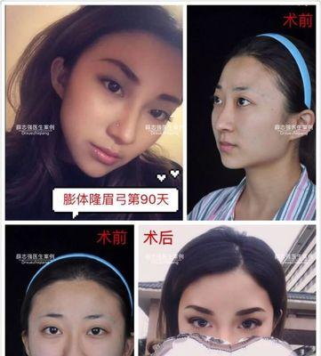 眼球外凸改善小方法（15种简单易行的方法让你拥有自然明亮的双眼）