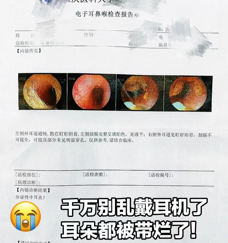 蓝牙耳机连接失败怎么办？如何排查问题？